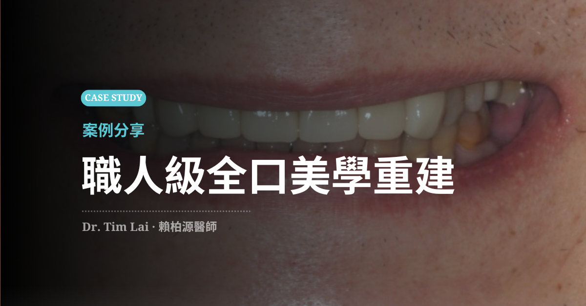 斷牙與四環黴素染色
