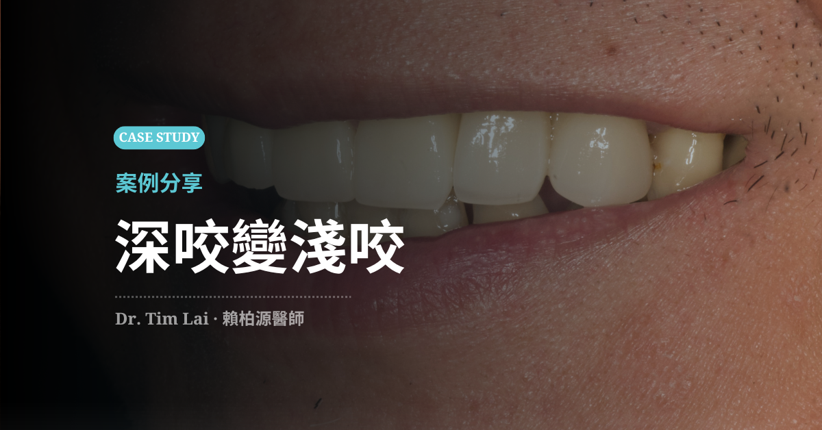 深咬變淺咬